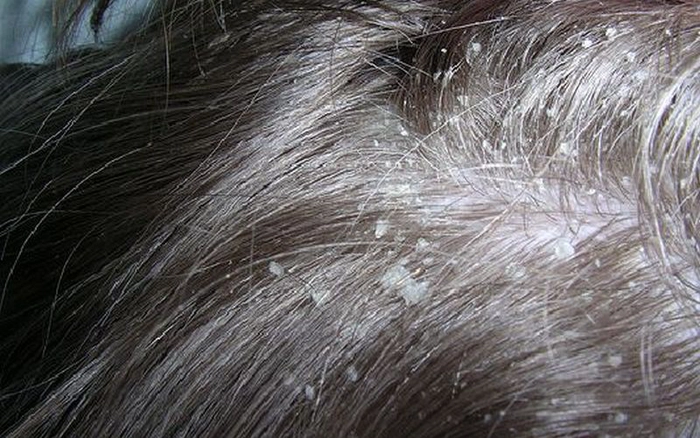 persoana care sufera de o boala in cap
