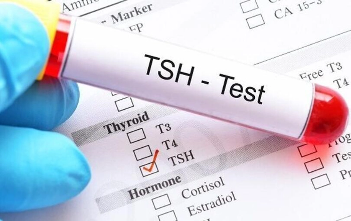 medic care tine in mana o eprubeta cu proba pentru un test tsh