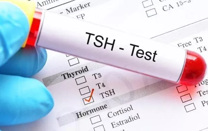 medic care tine in mana o eprubeta cu proba pentru un test tsh