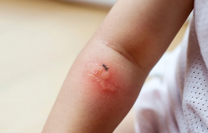 persoana muscata pe mana de o insecta