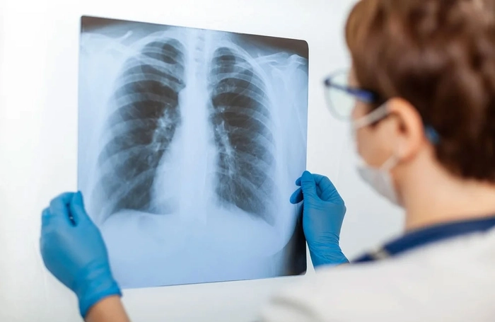 medic care priveste un rentghen la plamani