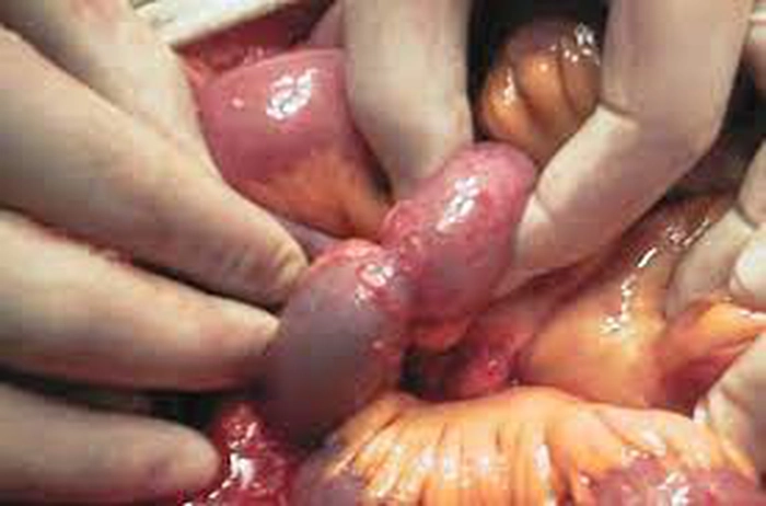infarct mezenteric