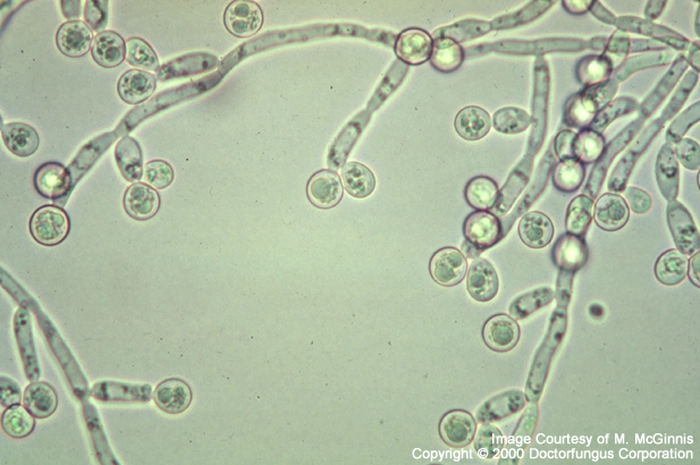 ciuperca candida la microscop