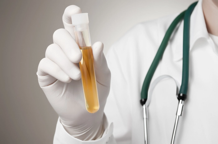 mana unui medic care tine o eprubeta cu substanta galbena