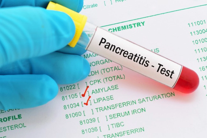 analize pentru pancreas
