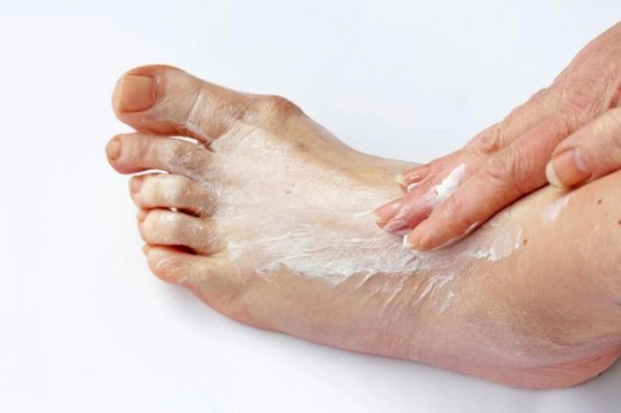 persoana care se da cu crema pe picior