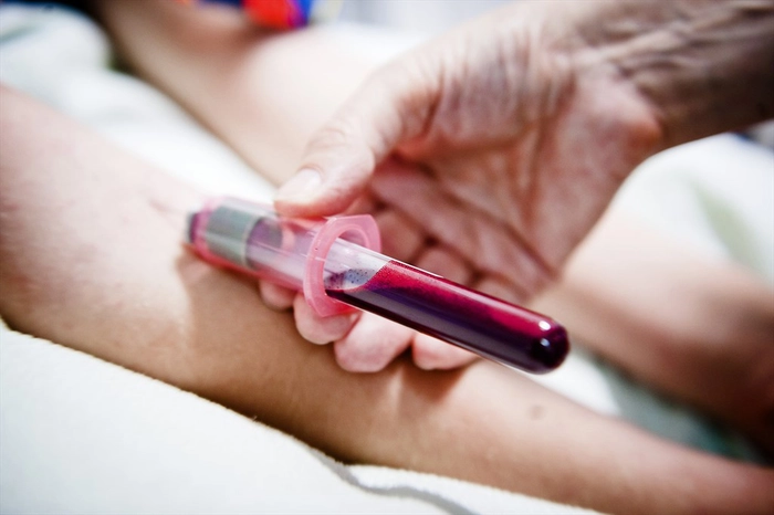 medic care ia sange din vena unei persoane pentru o analiza de sange