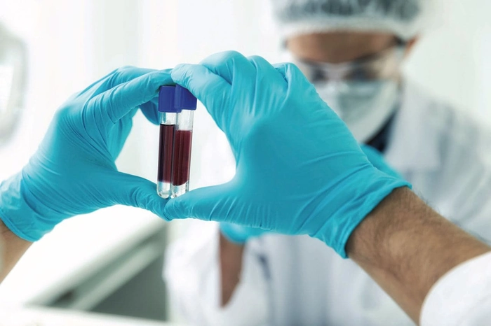 medic care tine doua eprubete cu sange in mana in fata unui alt medic