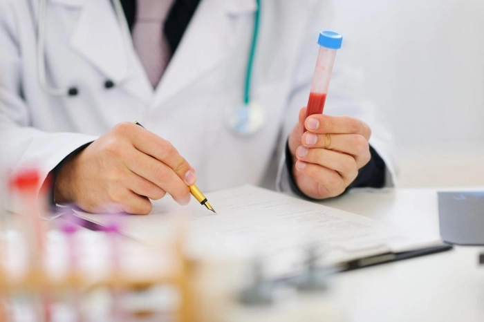 medic care tine o eprubeta cu proba de sange pentru prolactina