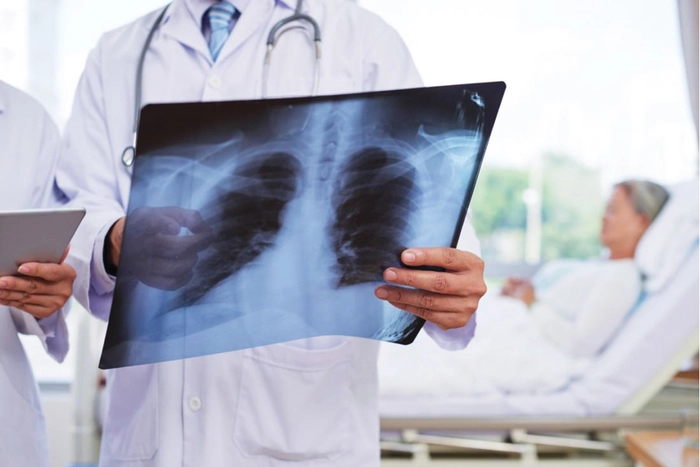 medic ce tine in mana o radiografie la plamani