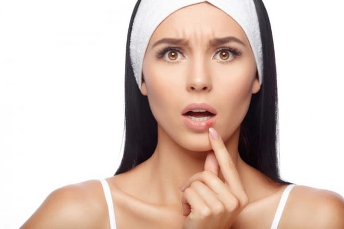 femeie care indica cu degetul spre o eruptie provocata de herpes