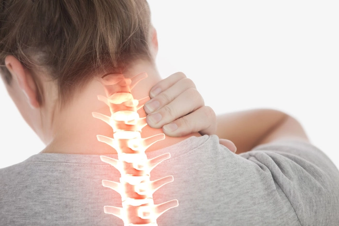 reprezentare spondiloza cervicala