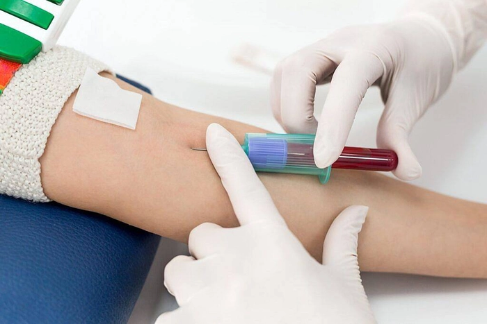 medic care ia proba de sange unei persoane din vena