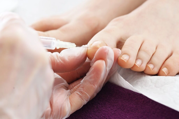 medic care pune o injectie in degetul unei persoane