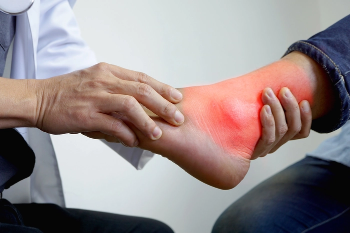 grafica medic care examineaza piciorul infectat de guta a unei persoane