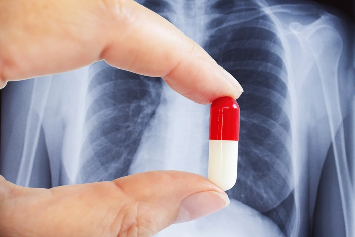 persoana care tine un antibiotic pe fonul unei fotografii de la roentgen