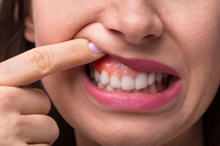 persoana care sufera de abces dentar