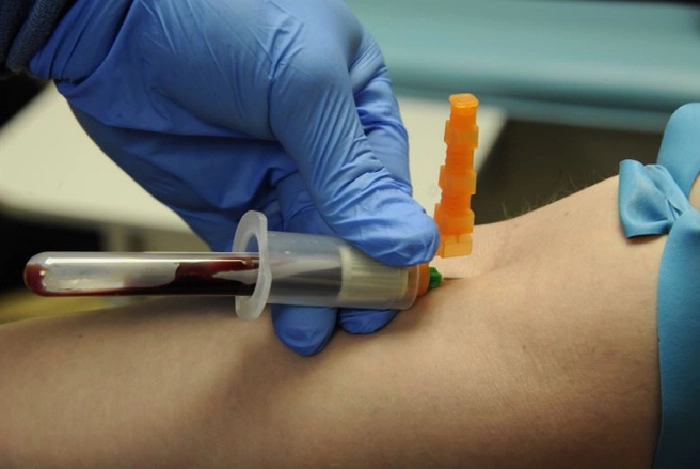 persoana careia i se ia sange pentru testare