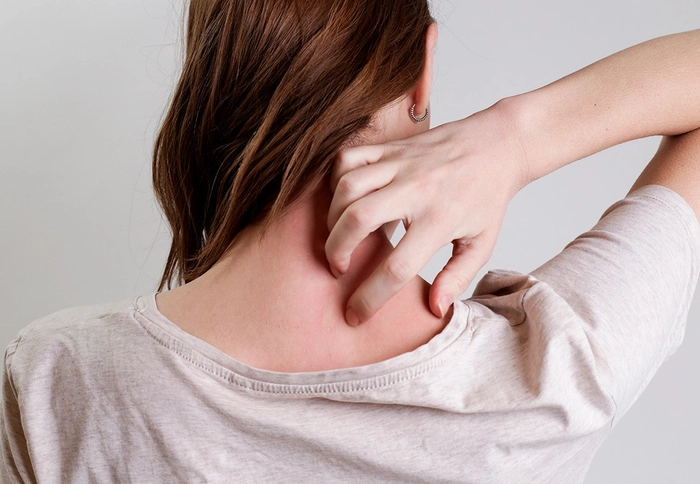 persoana care sufera de zona zoster