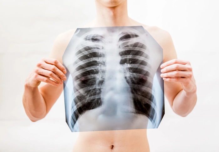 o radiografie pulmonară