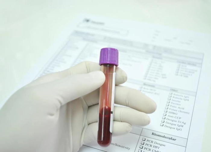 medic care tine in mana o eprubeta cu sange