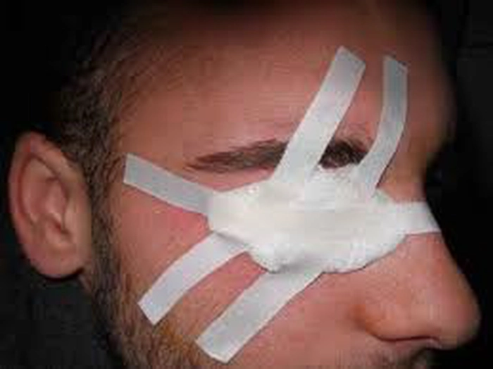 bărbat cu bandaj la ochi 