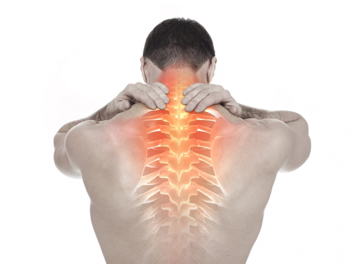 persoană care suferă de spondiloză cervicală