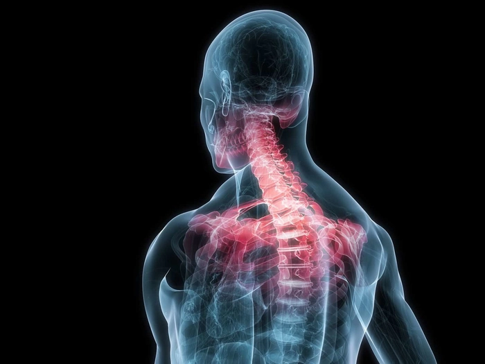 grafica cu un schelet ce are spondiloza cervicala