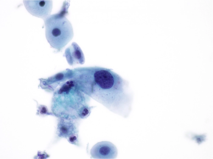 celule epiteliale scuamoase la nivel de microscop