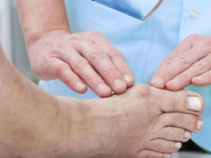 medic care examineaza piciorul infectat de guta a unei persoane