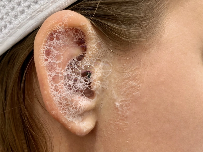 apa oxigenata in urechea unei femei