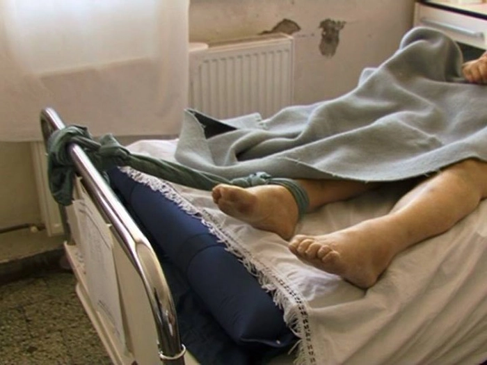 o imagine cu un pacient legat de pat