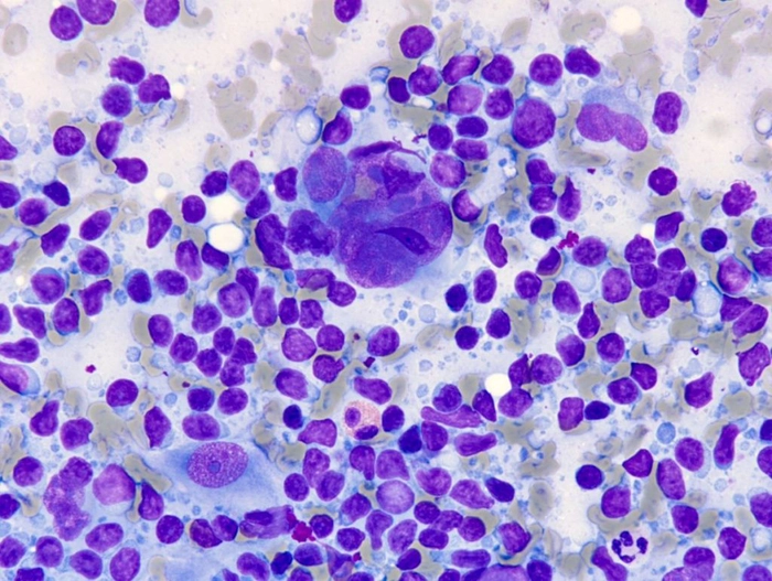 limfocite marite la nivelul microscopului