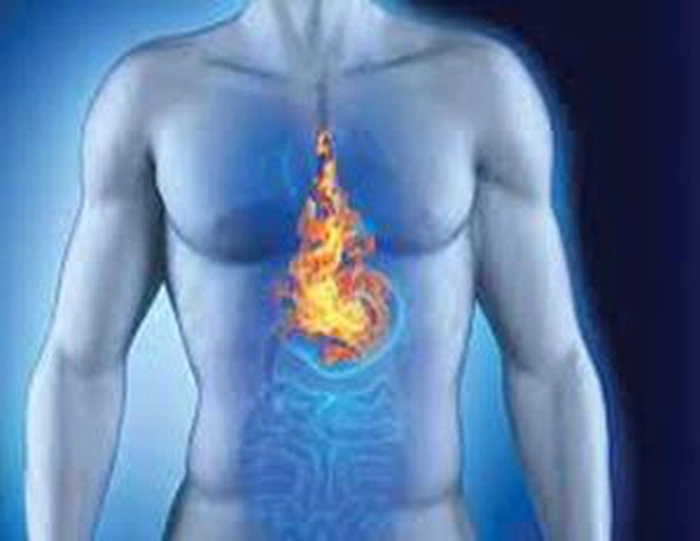 grafica persoana care sufera de reflux gastroesofagian