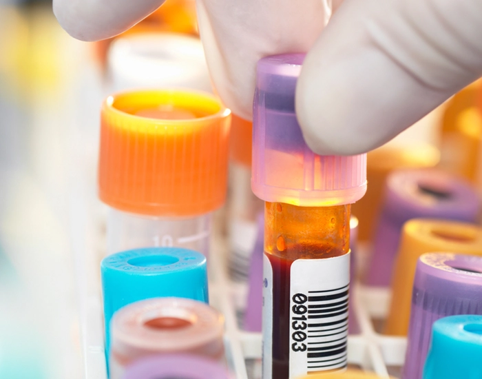 medic care ia o eprubeta cu analiza de sange 