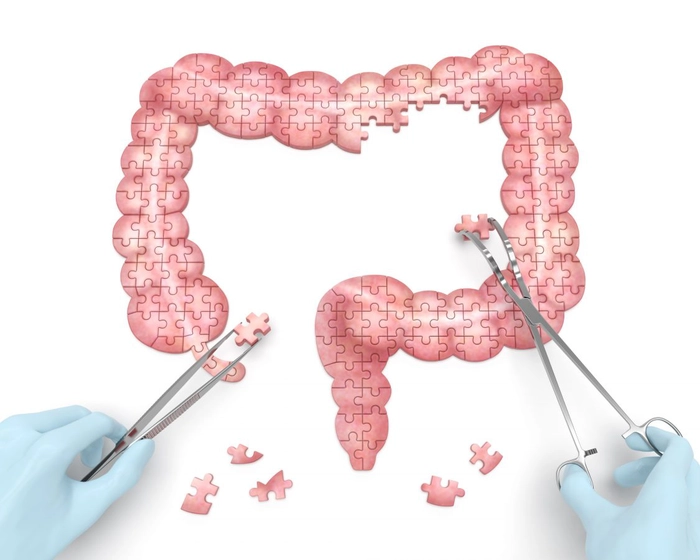 puzzle cu intestinul gros