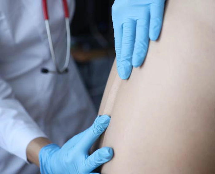  pacient hernie de disc