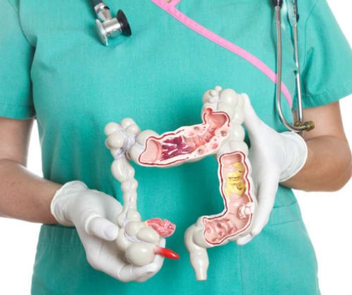 Un medic care ține un colon de plastic în mâini