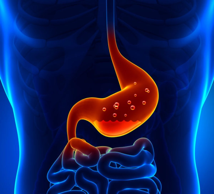 boala de reflux gastroesofagian
