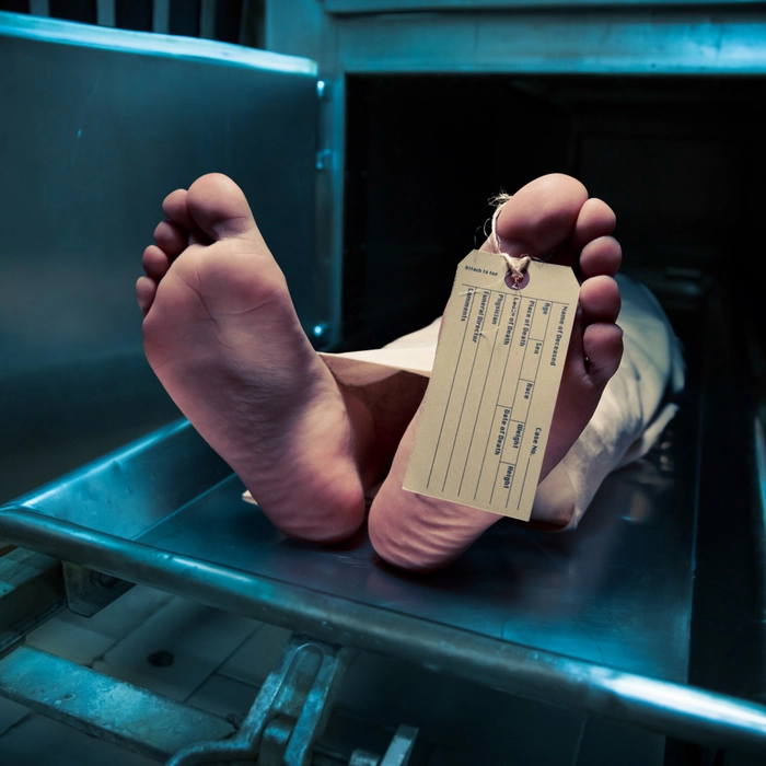  un cadavru pe o targa