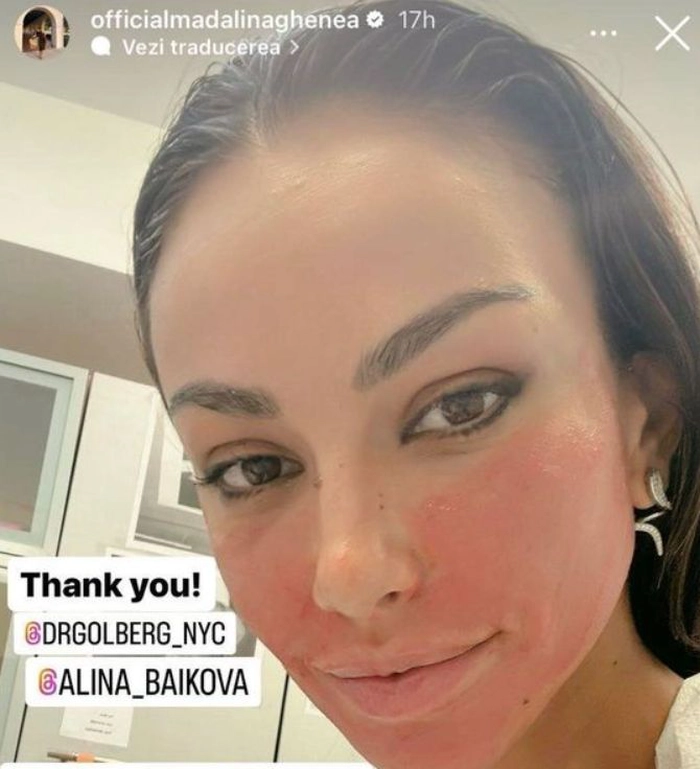 Mădălina Ghenea