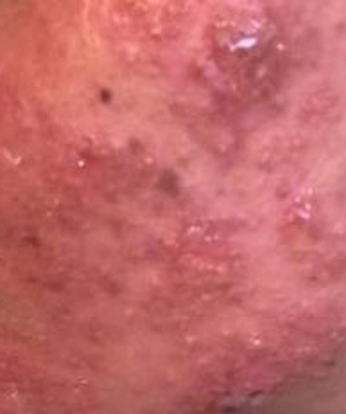 Persoana care a folosit schema de tratament prescrisa de Ioana Marinescu