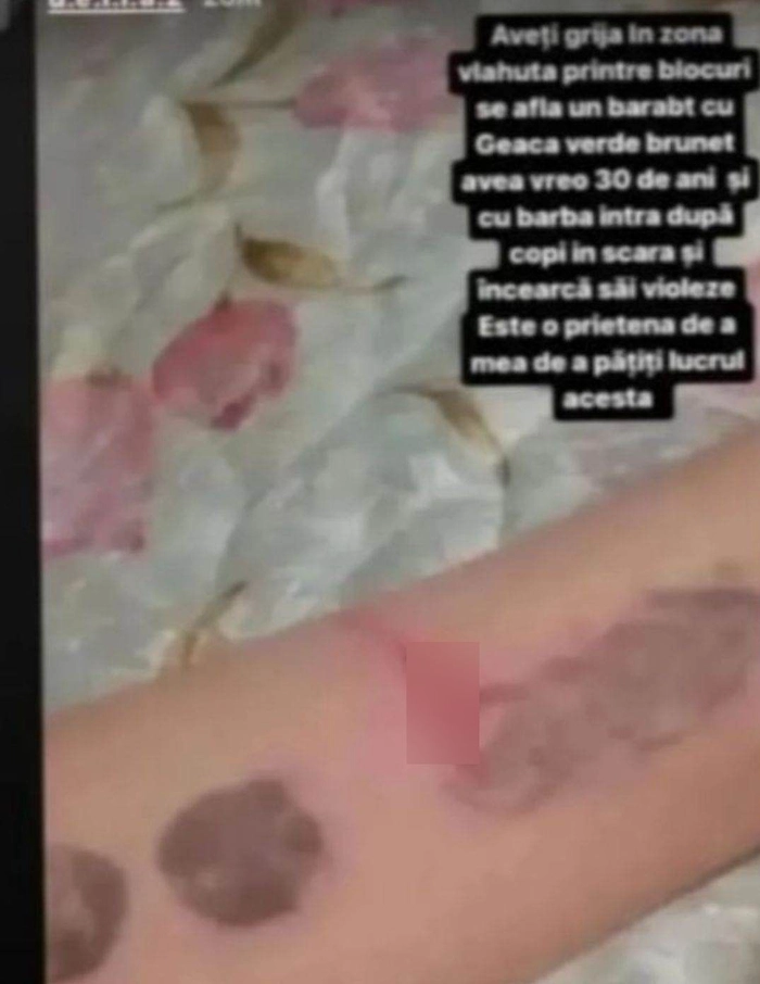 o imagine cu rana unui copil
