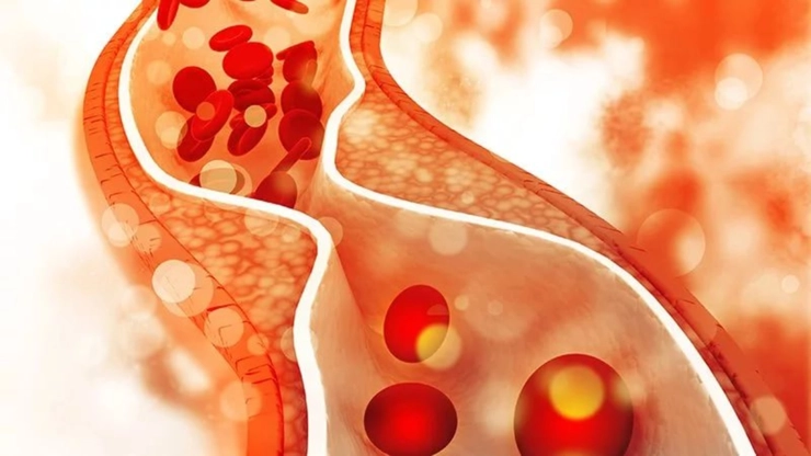 grafica analiza de colesterol in sange la nivelul microscopului
