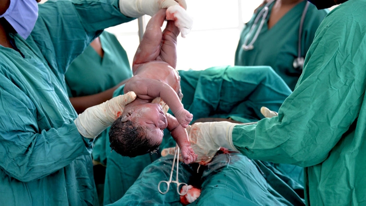un bebeluș născut prin cezariană