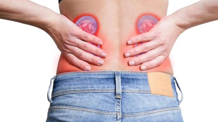 grafica femeie care se tine de spate din cauza durerilor provocate de rinichi