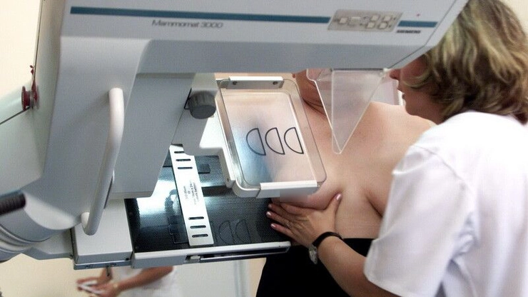  un medic care realizeaza o mamografie