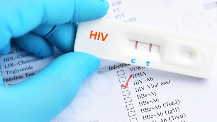  o imagine cu un test HIV