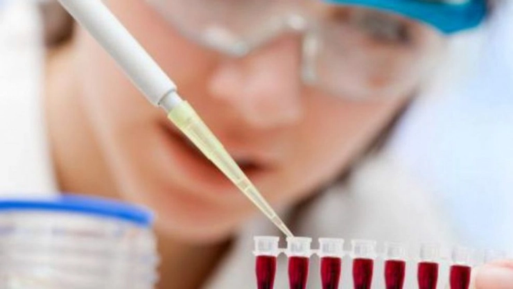 medic care analizeaza o proba de sange