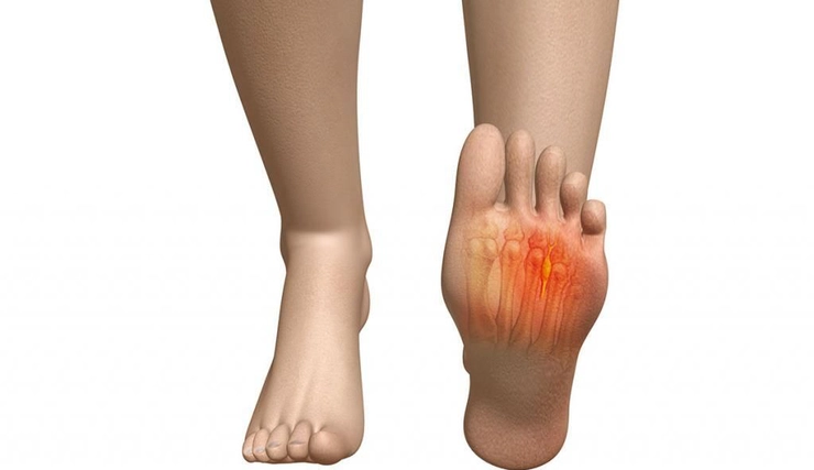 grafica persoana care sufera de durere in talpa piciorului